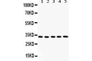 Anti-HSD11B1  antibody, Western blottingAll lanes: All lanes: Anti HSD11B1  at 0.