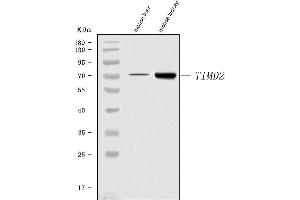 Western blot analysis of Tim 2/Timd2 using anti-Tim 2/Timd2 antibody (ABIN7602933). (TIMD2 antibody  (C-Term))