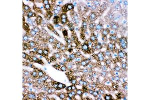 Anti- CYP2E1 antibody, IHC(P) IHC(P): Mouse Liver Tissue (CYP2E1 antibody  (AA 1-310))