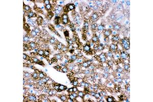 Anti- CYP2E1 antibody, IHC(P) IHC(P): Mouse Liver Tissue