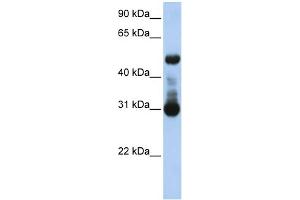WB Suggested Anti-ACVRL1 Antibody Titration:  0.