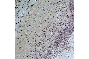 Immunohistochemical analysis of Bestrophin-1 staining in rat brain formalin fixed paraffin embedded tissue section.