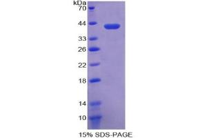SDS-PAGE analysis of Human Crystallin lambda 1 Protein. (CRYL1 Protein)