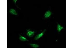 Image no. 5 for anti-Beclin 1, Autophagy Related (BECN1) antibody (ABIN1496869) (Beclin 1 antibody)