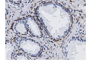 Immunohistochemical staining of paraffin-embedded Human liver tissue using anti-AK5 mouse monoclonal antibody. (Adenylate Kinase 5 antibody)