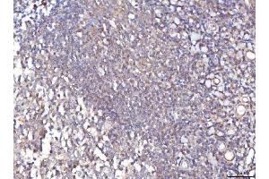 IHC analysis of TTC11/FIS1 using anti-TTC11/FIS1 antibody (ABIN7600321).