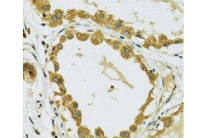 Immunohistochemistry of paraffin-embedded Human breast using RPS7 Polyclonal Antibody at dilution of 1:100 (40x lens). (RPS7 antibody)