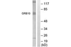 Western blot analysis of extracts from NIH-3T3 cells, treated with Insulin 0. (GRB10 antibody  (AA 33-82))