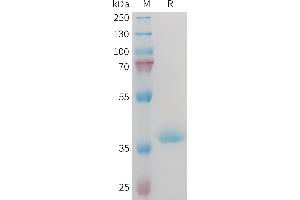 SDS-PAGE (SDS) image for Insulin-Like Growth Factor 1 (IGF1) protein (Fc Tag) (ABIN7538330)