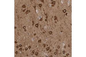 Immunohistochemical staining (Formalin-fixed paraffin-embedded sections) of human cerebral cortex with GPR61 polyclonal antibody  shows strong cytoplasmic positivity in neuronal cells. (GPR61 antibody)