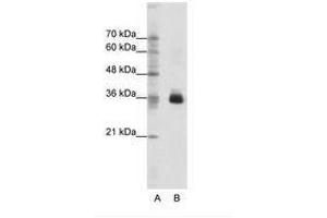 Image no. 1 for anti-Orthodenticle Homeobox 1 (OTX1) (C-Term) antibody (ABIN202328) (OTX1 antibody  (C-Term))