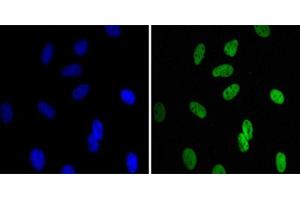 Immunofluorescence staining of HeLa cells using CBX1 monoclonal antibody, clone 5A3 (Green).