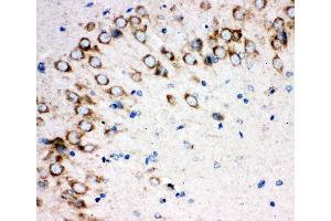 Anti-Sonic Hedgehog antibody,  IHC(P) IHC(P): Rat Brain Tissue (Sonic Hedgehog antibody  (N-Term))