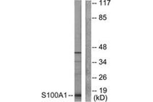 Western blot analysis of extracts from A549 cells, using S100 A1 Antibody. (S100A1 antibody  (AA 10-59))