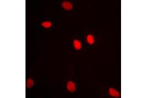 Immunofluorescent analysis of ADAR2 staining in MCF7 cells. (RED1 antibody  (Center))