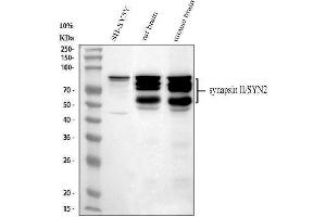 Western blot analysis of Synapsin II using anti-Synapsin II antibody (ABIN4886735). (SYN2 antibody  (AA 497-582))