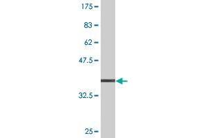 Western Blot detection against Immunogen (36. (PHTF1 antibody  (AA 248-347))