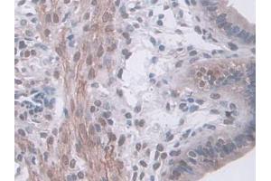 IHC-P analysis of Mouse Uterus Tissue, with DAB staining. (HSF4 antibody  (AA 159-411))
