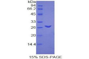 SDS-PAGE analysis of Rat TMEM173 Protein.