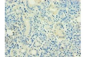 Immunohistochemistry of paraffin-embedded human pancreatic tissue using ABIN7155743 at dilution of 1:100 (HOXB5 antibody  (AA 1-170))