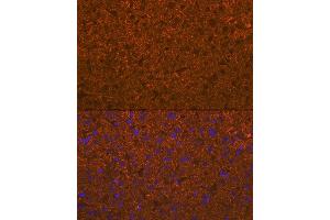 Immunofluorescence analysis of mouse liver using  Rabbit mAb (ABIN7265440) at dilution of 1:100 (40x lens). (ADAMTS13 antibody)