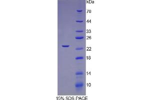 SDS-PAGE analysis of Rat TNNI1 Protein. (TNNI1 Protein)