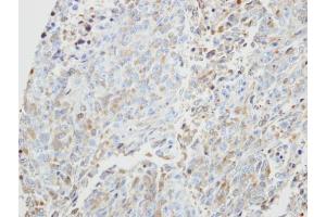 IHC-P Image Immunohistochemical analysis of paraffin-embedded H3347 xenograft, using PRKX, antibody at 1:500 dilution. (PRKX antibody)