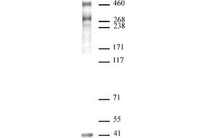 SMRT / NCoR2 antibody (pAb) tested by Western blot.