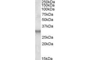 Western Blotting (WB) image for anti-Integral Membrane Protein 2B (ITM2B) (Internal Region) antibody (ABIN570955)