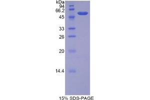 SDS-PAGE analysis of Human BSDL Protein. (Lipase, Bile Salt Dependent Protein)