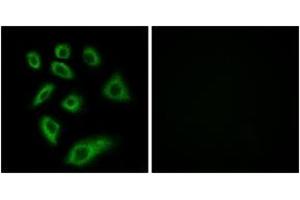 Immunofluorescence (IF) image for anti-Cytochrome P450, Family 2, Subfamily W, Polypeptide 1 (CYP2W1) (AA 311-360) antibody (ABIN2889950) (CYP2W1 antibody  (AA 311-360))