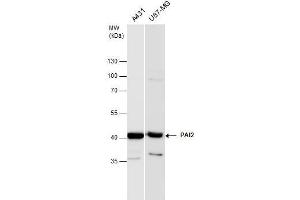 WB Image PAI2 antibody detects PAI2 protein by western blot analysis.