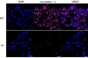 Immunocytochemical staining of Hela cells using Peroxiredoxin 3 antibody (ABIN7799778), 1:1,000), Top panel: wild-type (WT), Bottom panal: Peroxiredoxin 3 shRNA knockdown (KD). (Recombinant Peroxiredoxin 3 antibody)