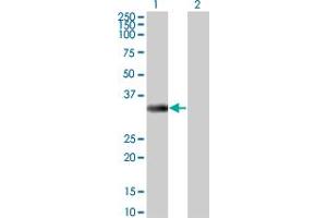 Western Blot analysis of ITPK1 expression in transfected 293T cell line by ITPK1 monoclonal antibody (M01), clone 2C8.