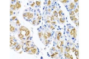 Immunohistochemistry of paraffin-embedded Human stomach using FECH Polyclonal Antibody at dilution of 1:100 (40x lens).