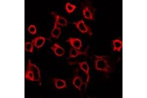 Immunofluorescent analysis of EP2 staining in HuvEc cells. (PTGER2 antibody  (C-Term))