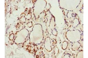 Immunohistochemistry of paraffin-embedded human thyroid tissue using ABIN7163952 at dilution of 1:100