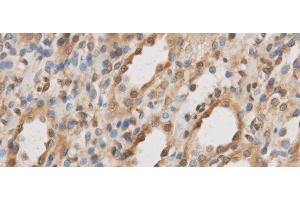 Immunohistochemistry of paraffin-embedded Rat kidney using IL10RB Polyclonal Antibody at dilution of 1:50