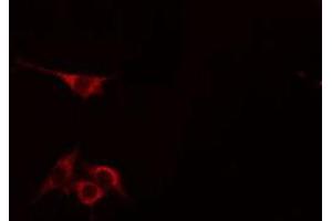 ABIN6275098 staining HepG2 cells by IF/ICC. (UBR1 antibody  (Internal Region))
