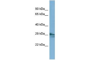 WB Suggested Anti-LIM2 Antibody Titration:  0. (LIM2 antibody  (N-Term))
