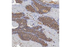 IHC analysis of ACAD9 using anti-ACAD9 antibody (ABIN7602670). (ACAD9 antibody  (AA 92-621))