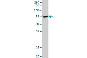 SLC25A13 monoclonal antibody (M01), clone 4F4 Western Blot analysis of SLC25A13 expression in HepG2 . (slc25a13 antibody  (AA 2-80))