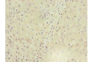Immunohistochemistry of paraffin-embedded human liver tissue using ABIN7143763 at dilution of 1:100 (MGAT1 antibody  (AA 156-445))