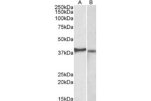 ABIN5539502 (2µg/ml) staining of Kelly (A) and U251-MG (B) lysates (35µg protein in RIPA buffer). (CX3CR1 antibody  (AA 34-47))