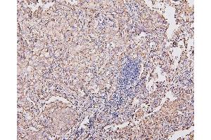 IHC analysis of COX IV using anti-COX IV antibody (ABIN7602090). (COX IV antibody  (AA 59-169))