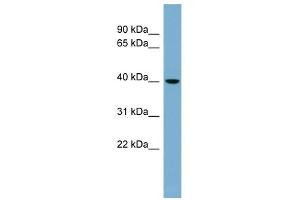 VPS37C antibody used at 1 ug/ml to detect target protein. (VPS37C antibody)