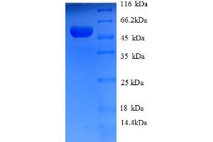 SDS-PAGE (SDS) image for Hydroxyacylglutathione Hydrolase (HAGH) (AA 50-308), (partial) protein (GST tag) (ABIN4976410) (HAGH Protein (AA 50-308, partial) (GST tag))