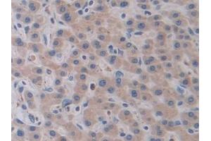 Detection of CTSV in Human Liver Tissue using Polyclonal Antibody to Cathepsin V (CTSV) (Cathepsin L2 antibody  (AA 64-334))