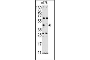 Image no. 1 for anti-Farnesyl-Diphosphate Farnesyltransferase 1 (FDFT1) (Middle Region) antibody (ABIN357712) (FDFT1 antibody  (Middle Region))