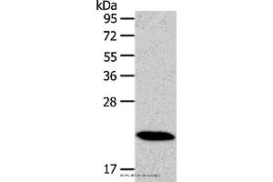 Western blot analysis of Mouse heart tissue, using RAB18 Polyclonal Antibody at dilution of 1:400 (RAB18 antibody)